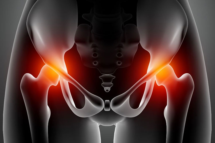 Clínica de Hernias CANADI