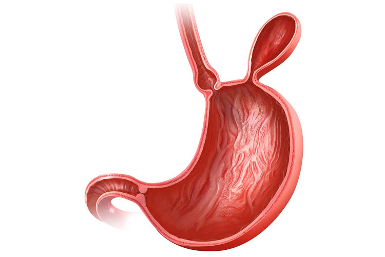 Clínica de Hernias CANADI